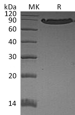 Human CDH1 +SDS-PAGE-1.jpg